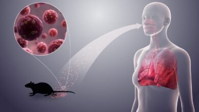Hantavirus U3oc8djgwp