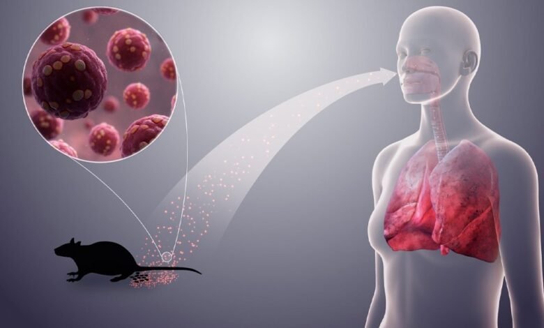 Hantavirus U3oc8djgwp